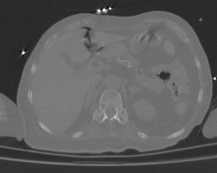 Radiology Tutorial Cases (CT,MRI) (@Ganymade__) / Posts / X