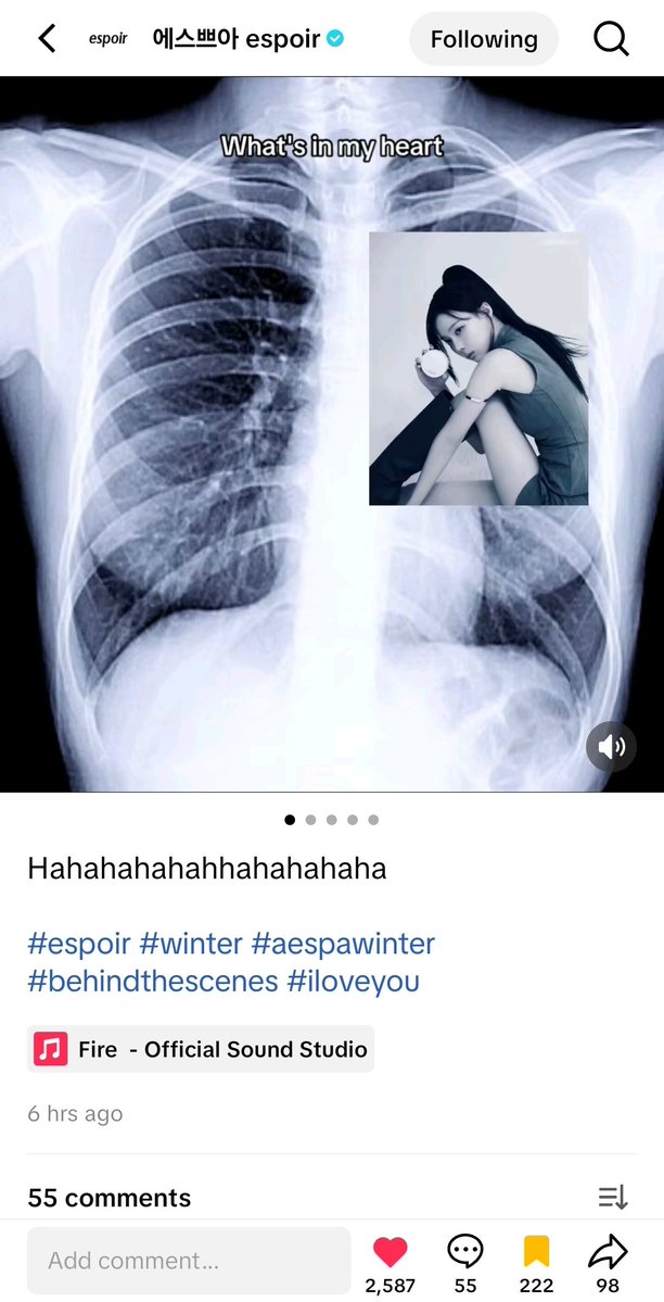 𝐅⋆🥨 tweet media