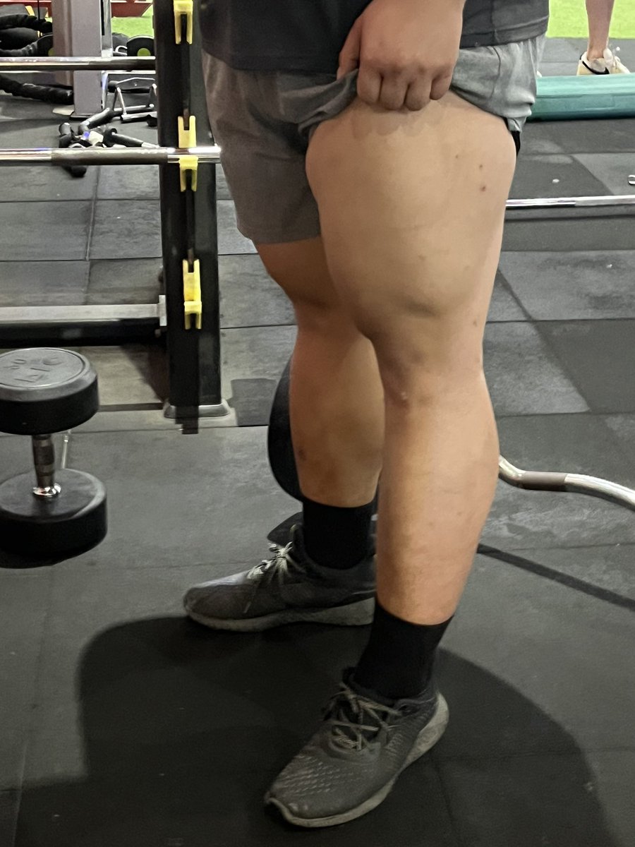 小欧要减脂 tweet media