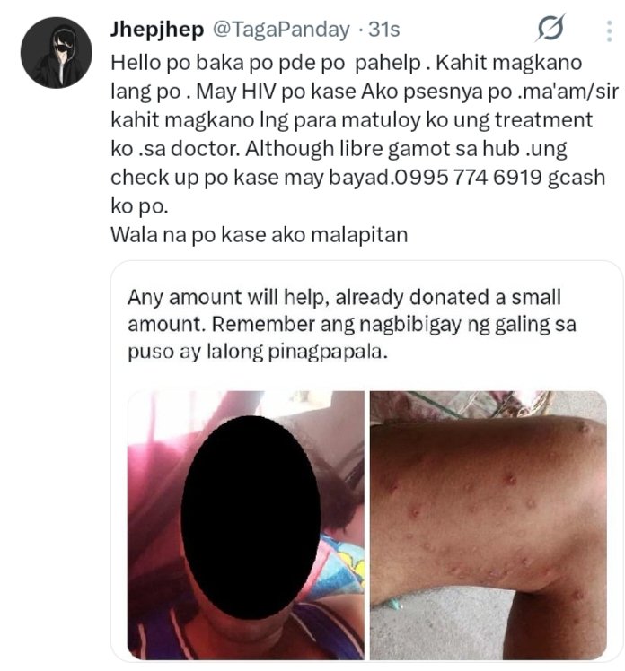 Jhepjhep tweet media