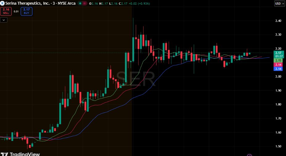 $SER breaks through $1.60 resistance on heavy +95M volume 🚀

+70% surge with a technical setup now targeting the $3.48 zone

$30M private placement adds a strong fundamental catalyst behind the move. 

$ELA $DLTH $MOBX $XBI $IBB $BIIB