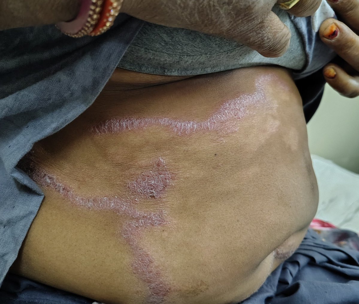 Dr. Js choudhary (@jschoud76335852) on Twitter photo 