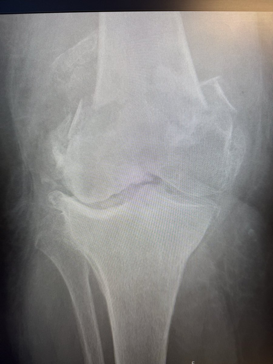 SP Orthopaedics tweet media