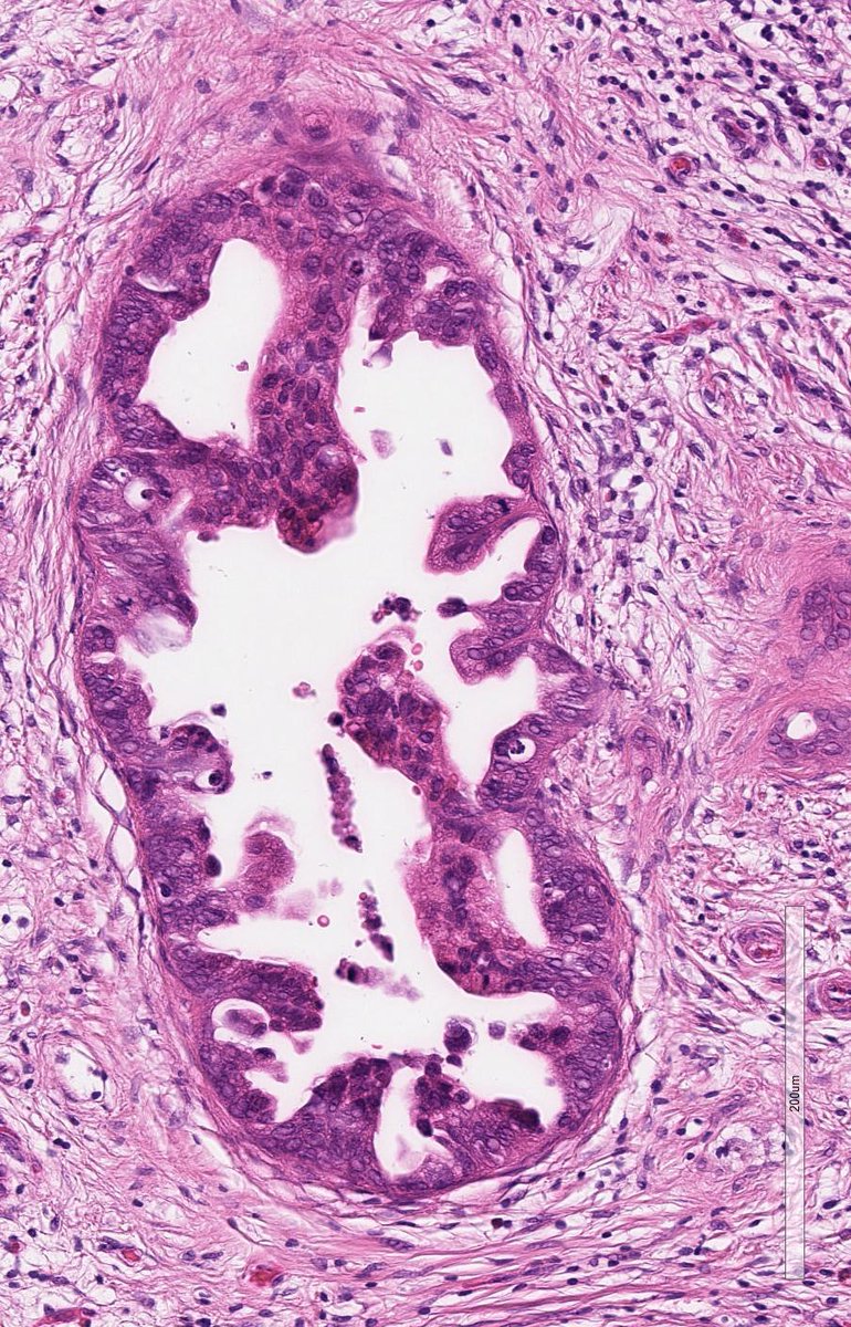 Charlie Herndon tweet media