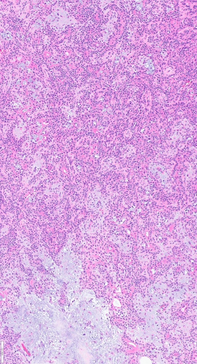 Zemplén Pataki, MD, PhD tweet media