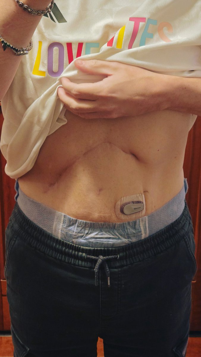 Krisz 🧑‍🦰🐺 tweet media