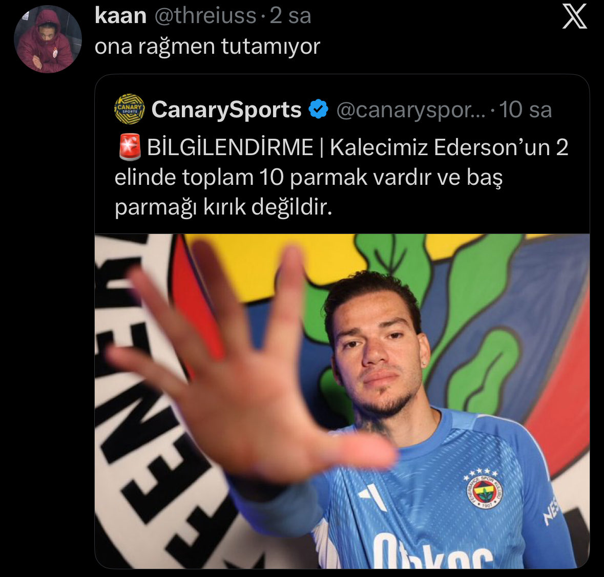 kerem saç kaybı tweet media