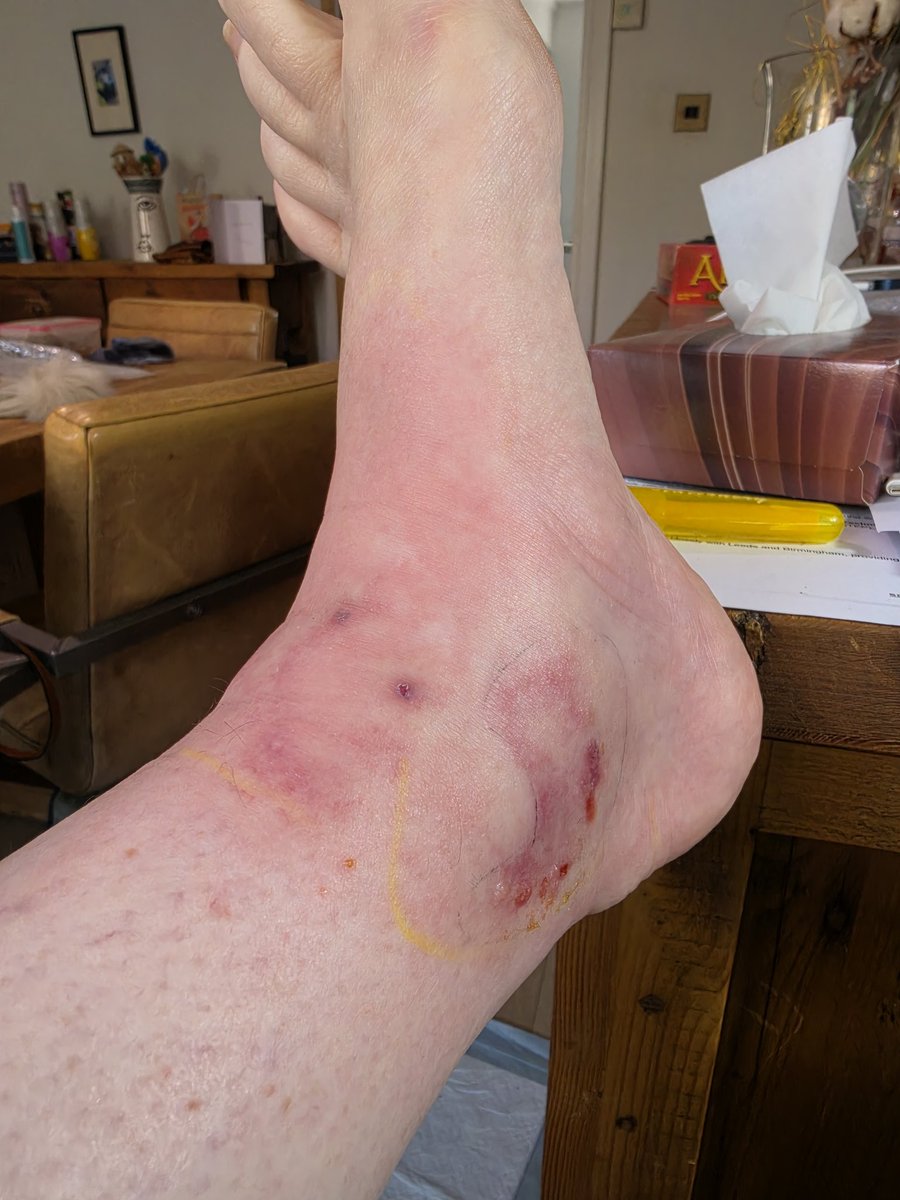 The Wise Woman ish anyway 🎗 tweet media