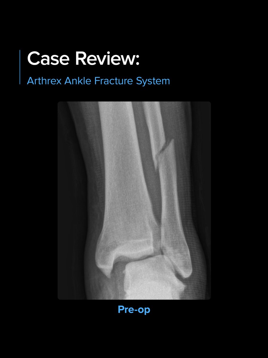 Arthrex MedEd tweet media