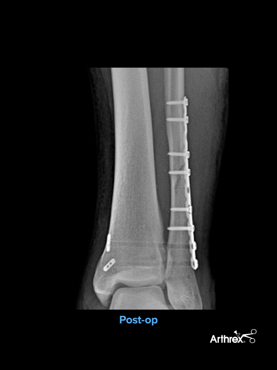 Arthrex MedEd tweet media