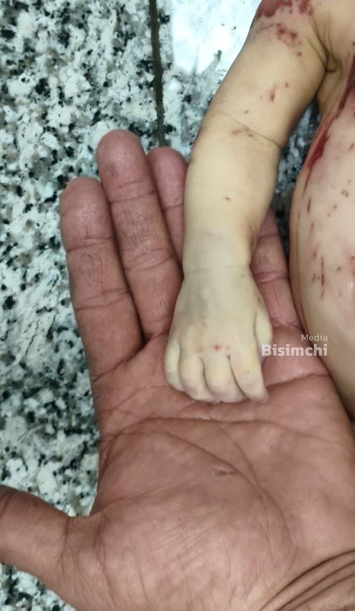 نوزاد شهید، با بدنی پاره‌پاره
آزادی بابا ترامپتون و عمو نتانیاهو