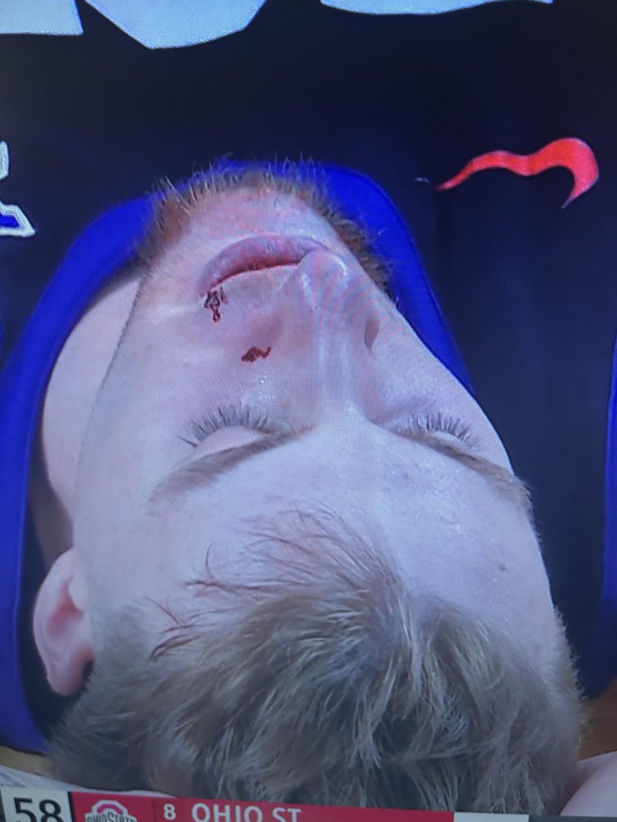 Joey Puckflaps tweet media