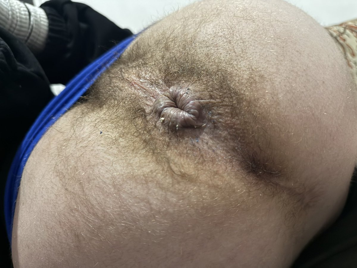 poop hole👾 tweet media