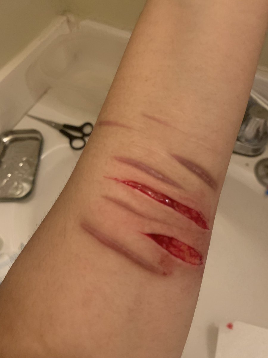 siamesedoe's tweet photo. hated the length of them https://t.co/FcdgbWA3Sa