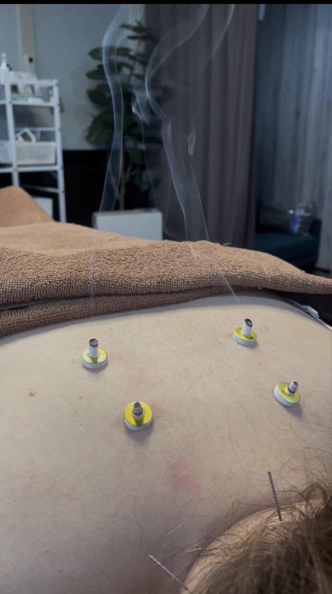 鍼灸＆整体 icoi.Labo @足利 tweet media