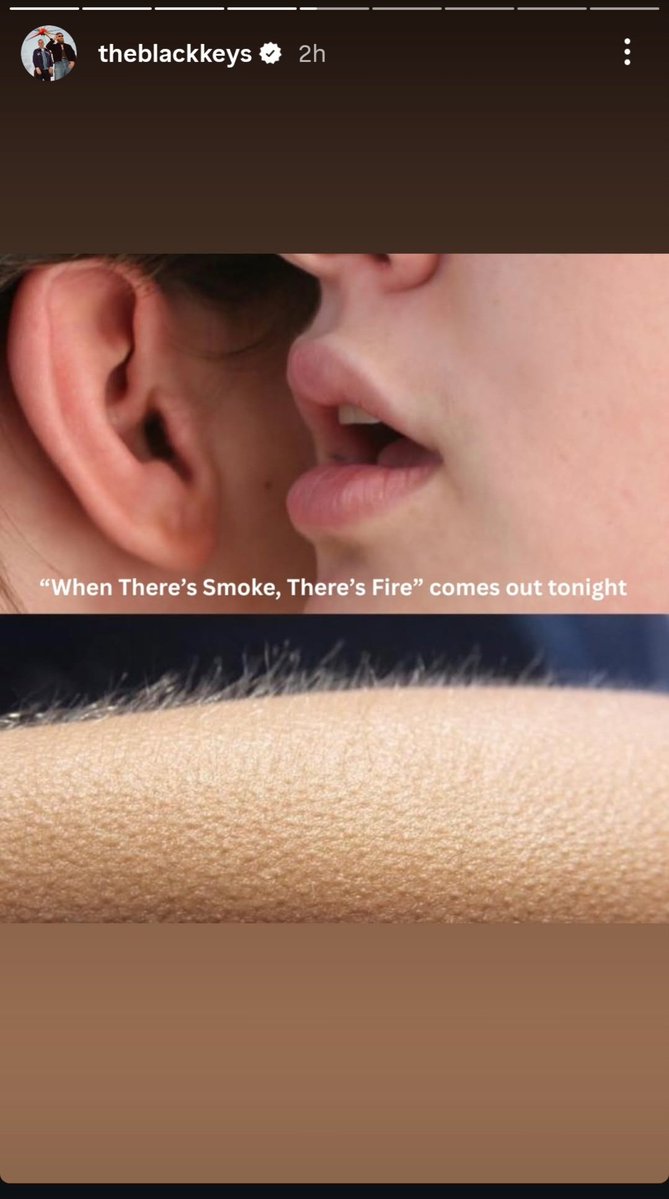 Finding Aureus (Beautiful Beautiful out NOW!) tweet media