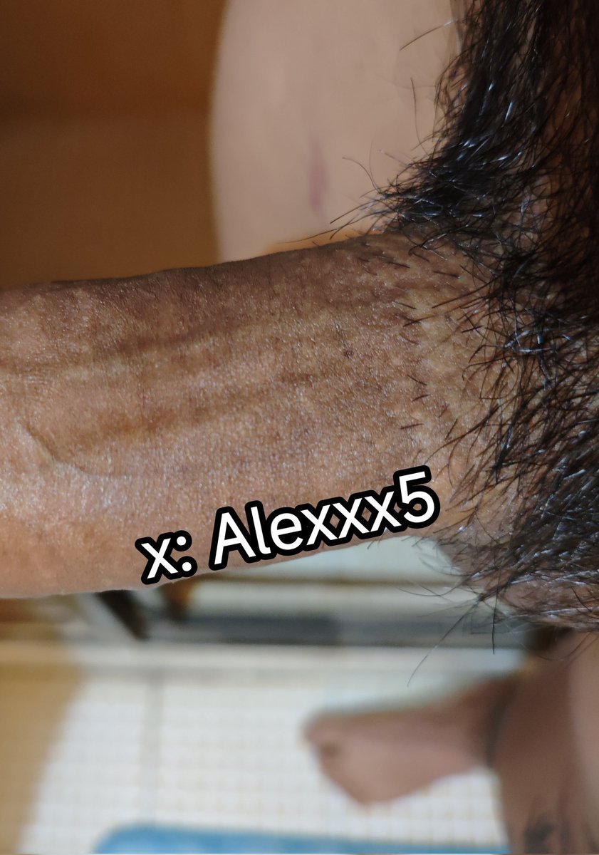Alexxx5 tweet media