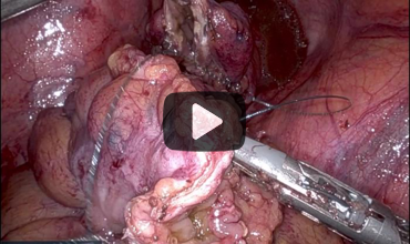 General Surgery News tweet media