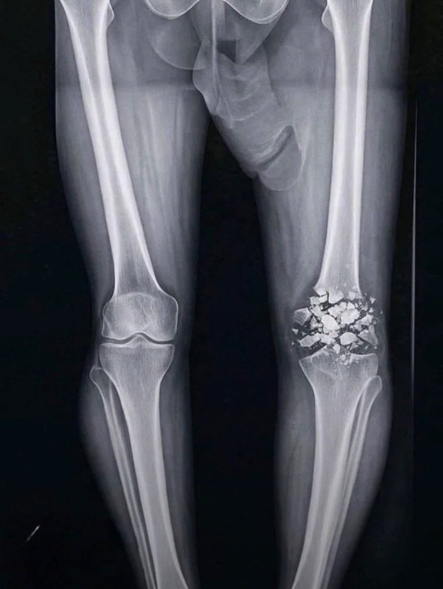 @N5@R1 👬🏼🐈🔞 tweet media