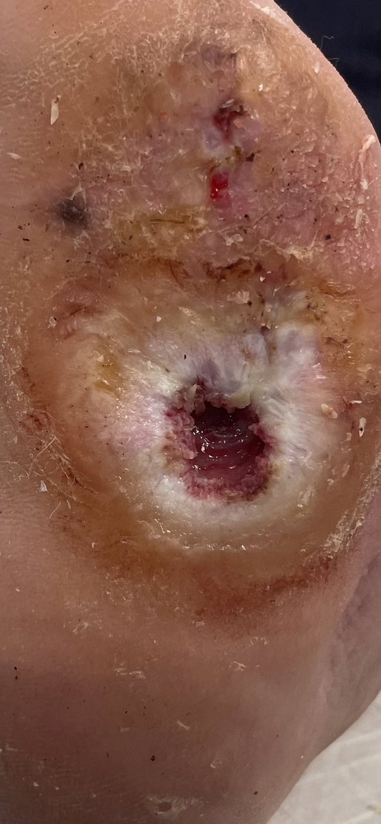 Runyonesque tweet media