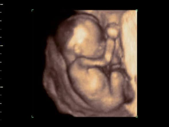 Bully 🇩🇪 tweet media