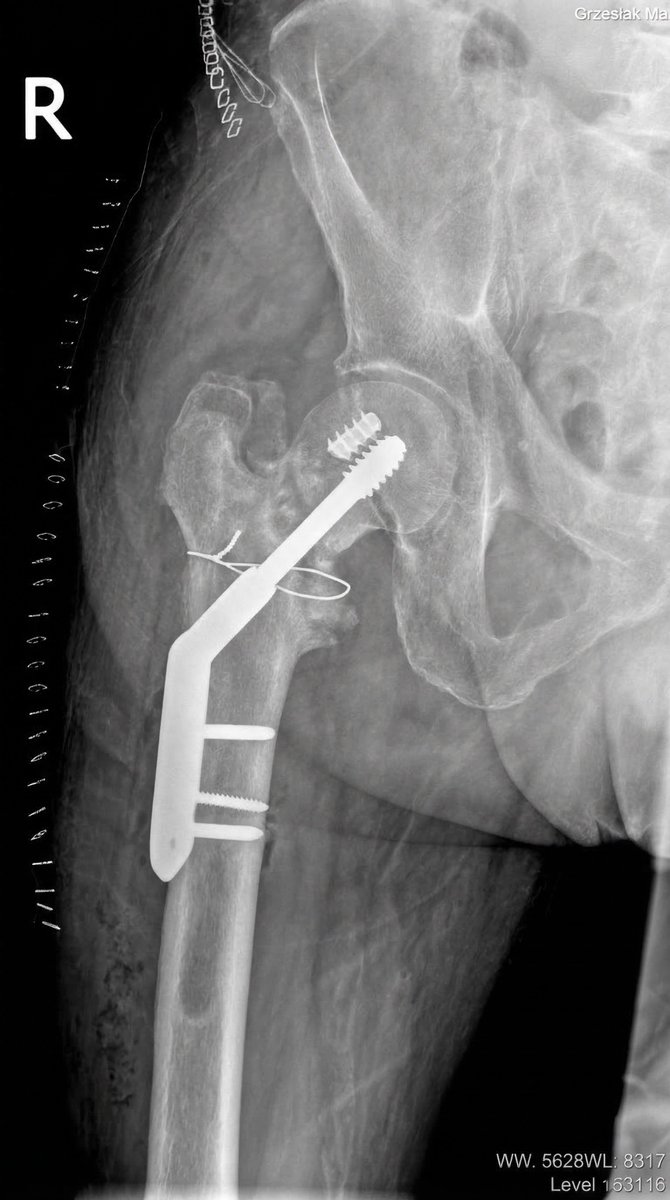 ImprezowyKotek tweet media