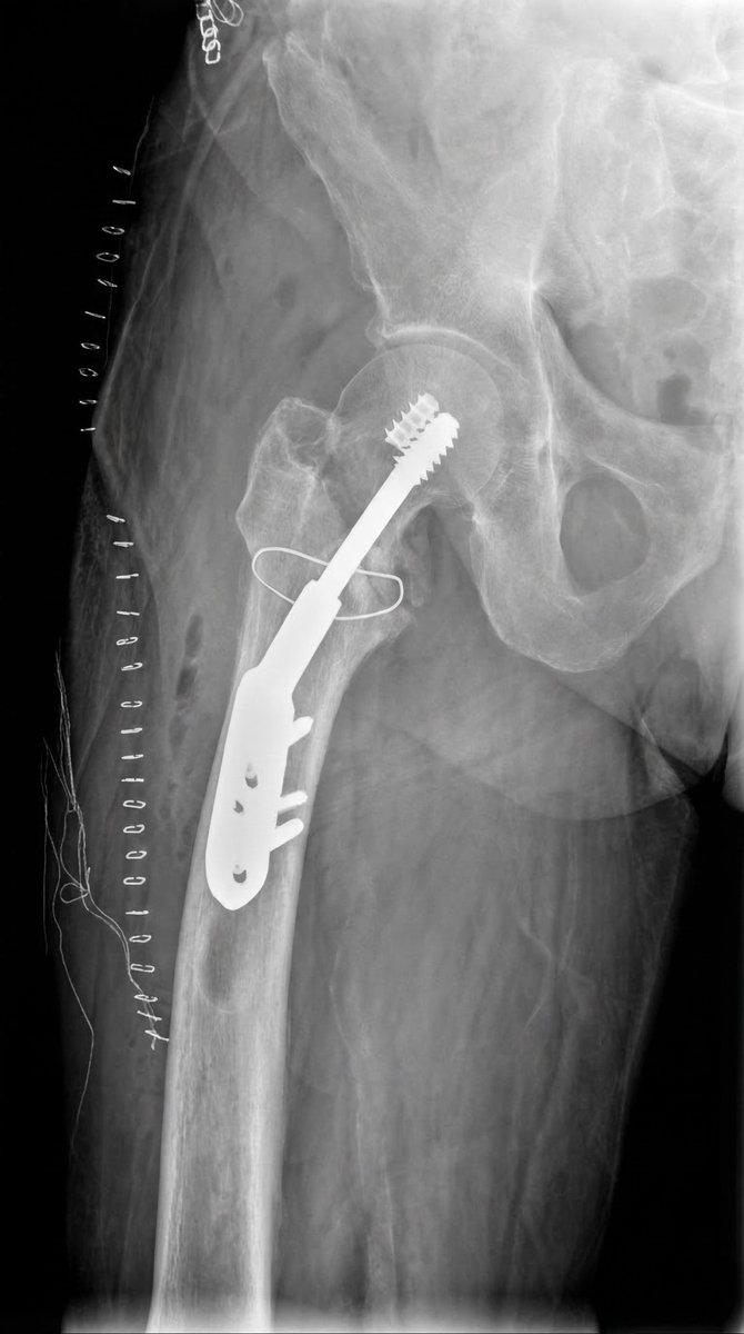 ImprezowyKotek tweet media