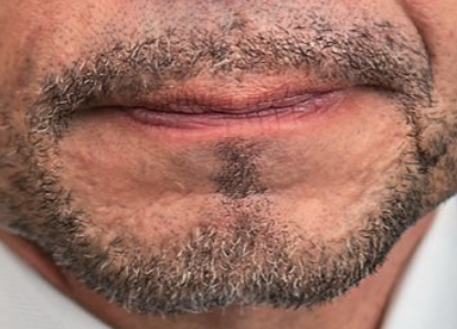 CsquidCo tweet media