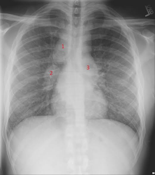 Itebimien Peter tweet media