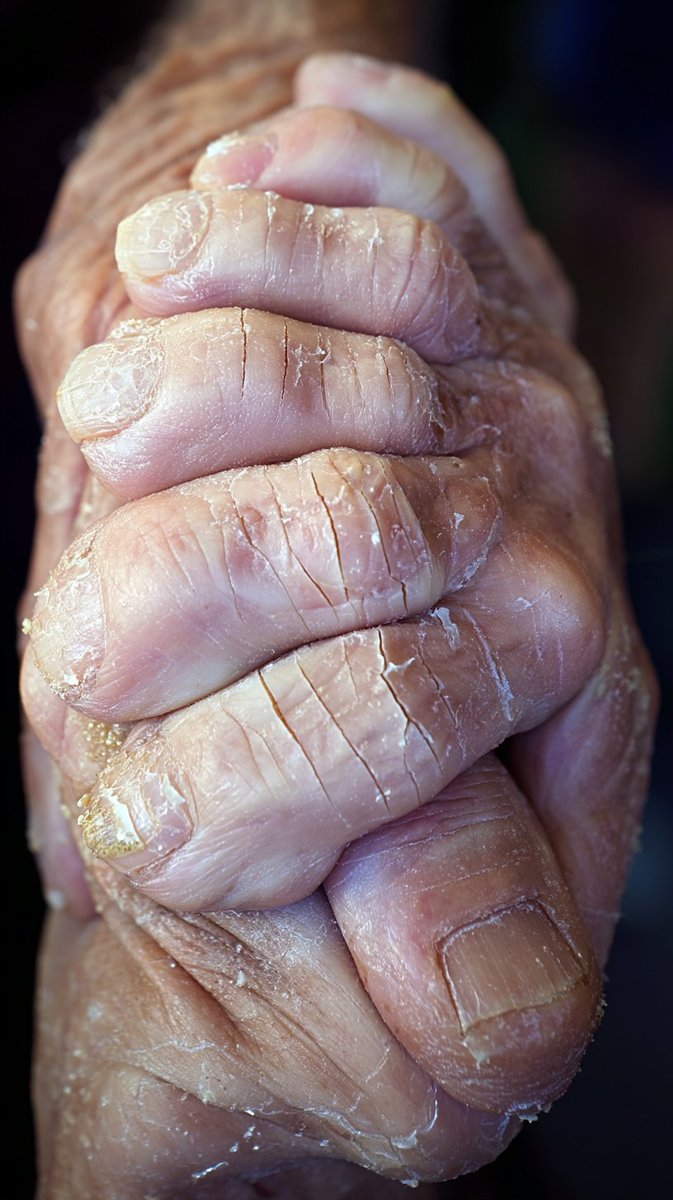 Lola Viscera tweet media