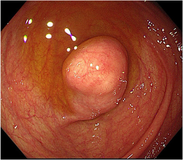 VideoGIE Journal tweet media