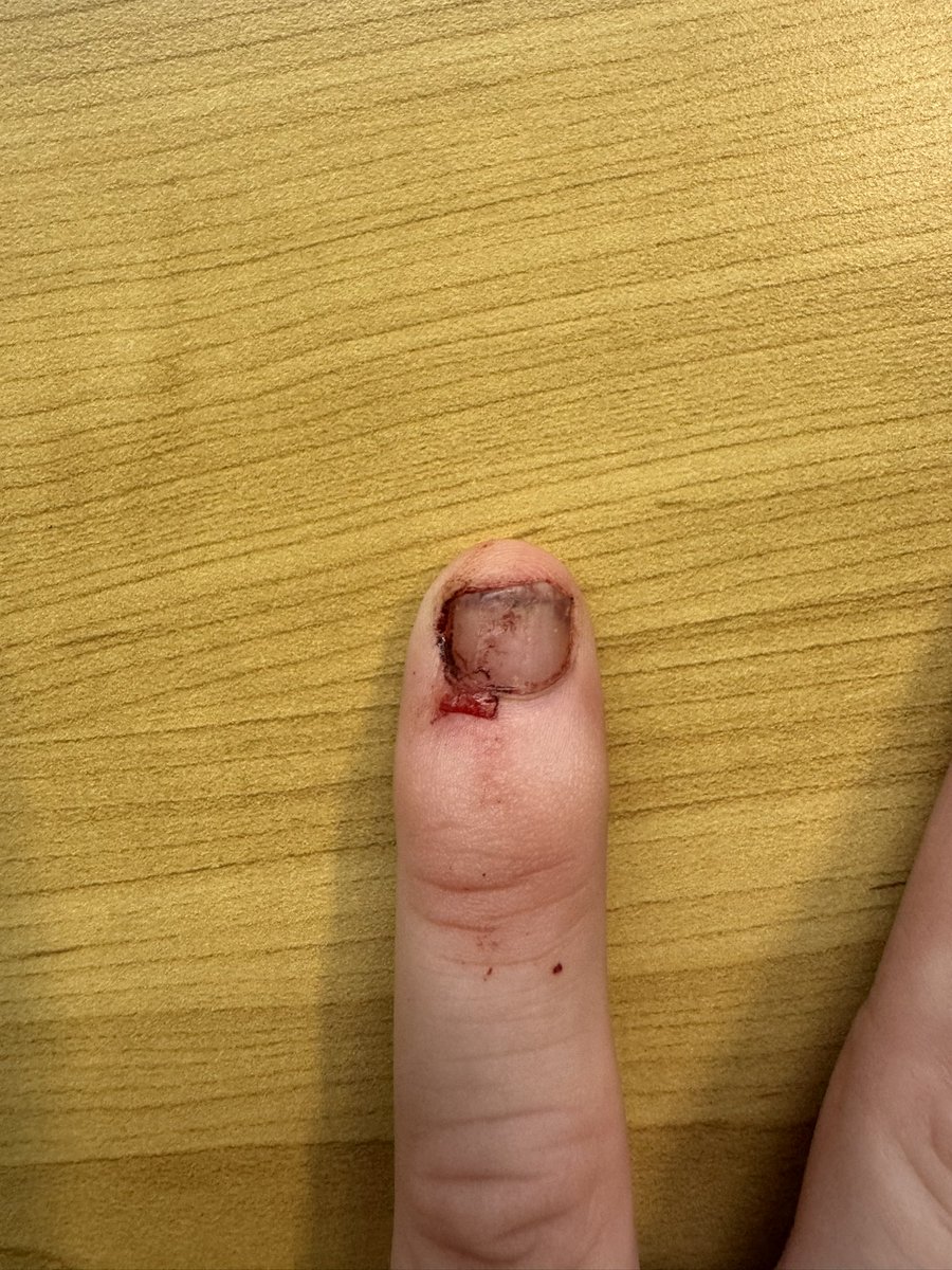 Dang. That’s my nose pickin’ digit