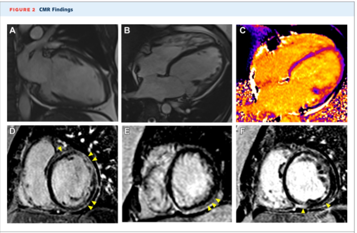 Rocío Blanco, MD 🇦🇷 tweet media
