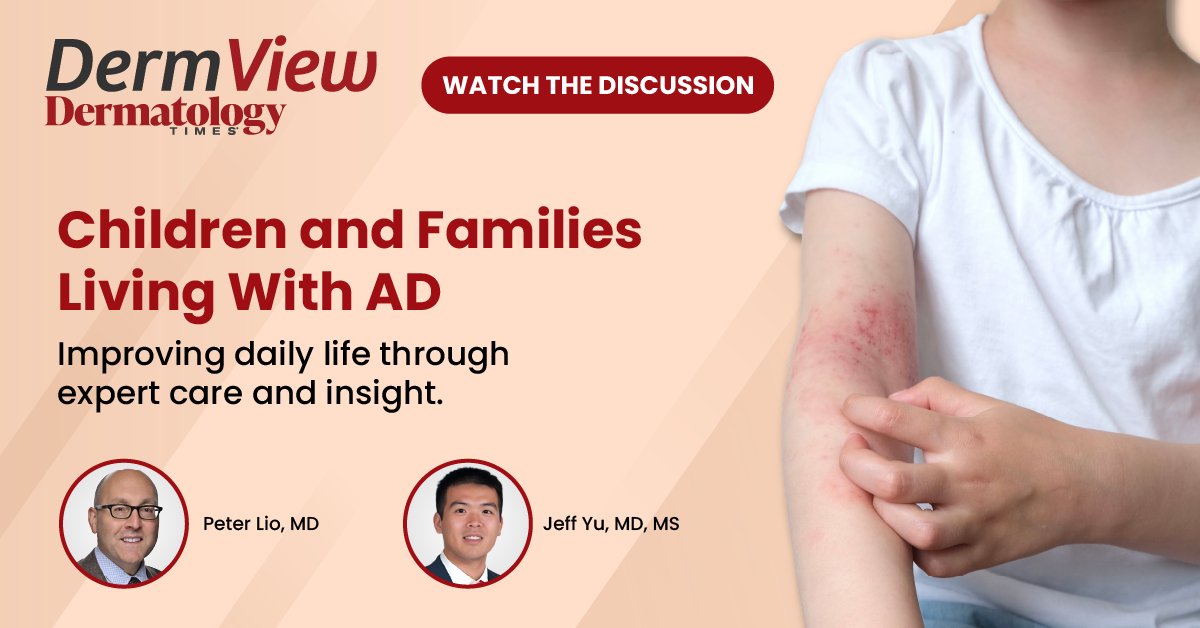 Dermatology Times tweet media