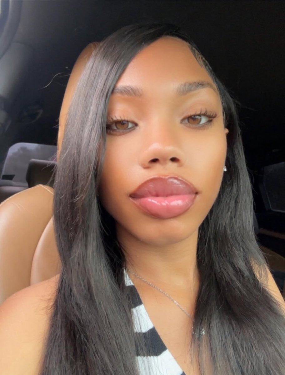 Allure  tweet media