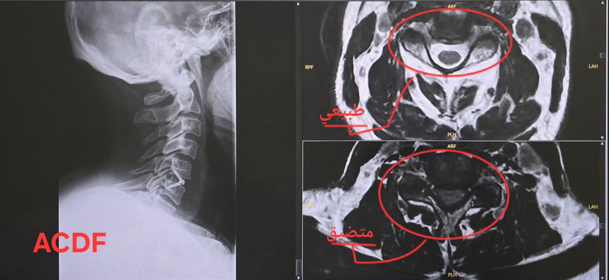د.ضاوي العتيبي tweet media