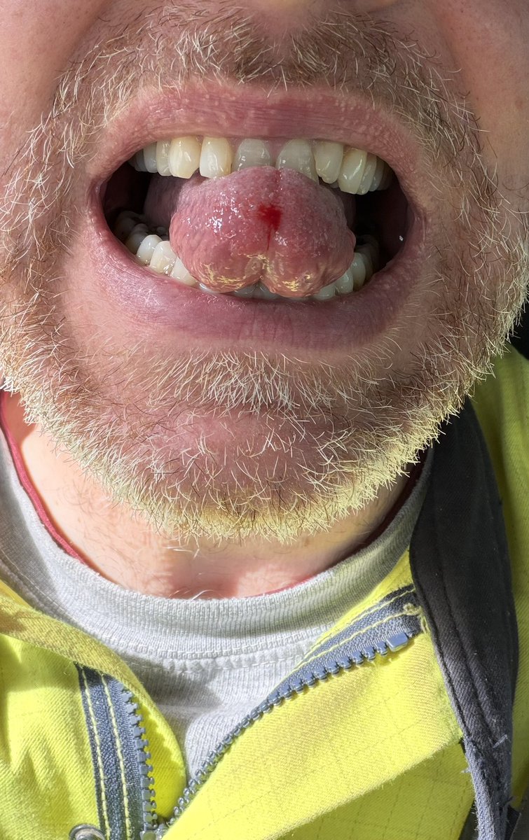 ThatFella_UK tweet media