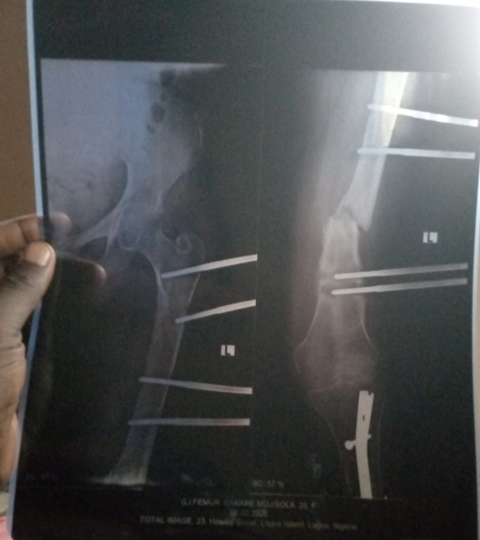 MojisolaBakare tweet media