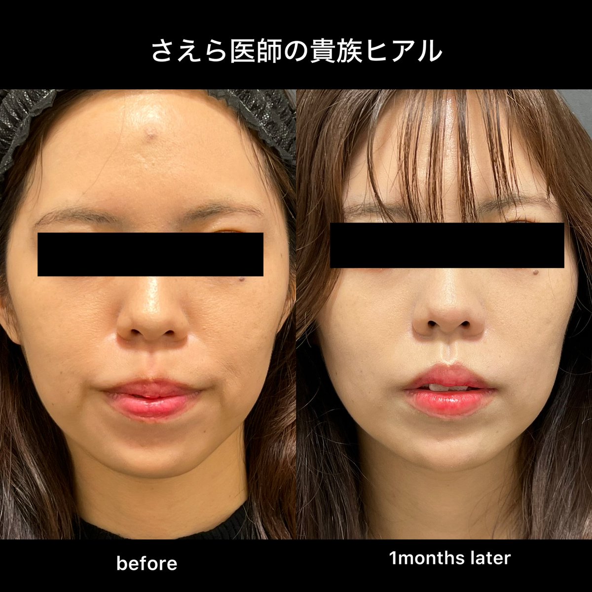 美容外科医さえら tweet media