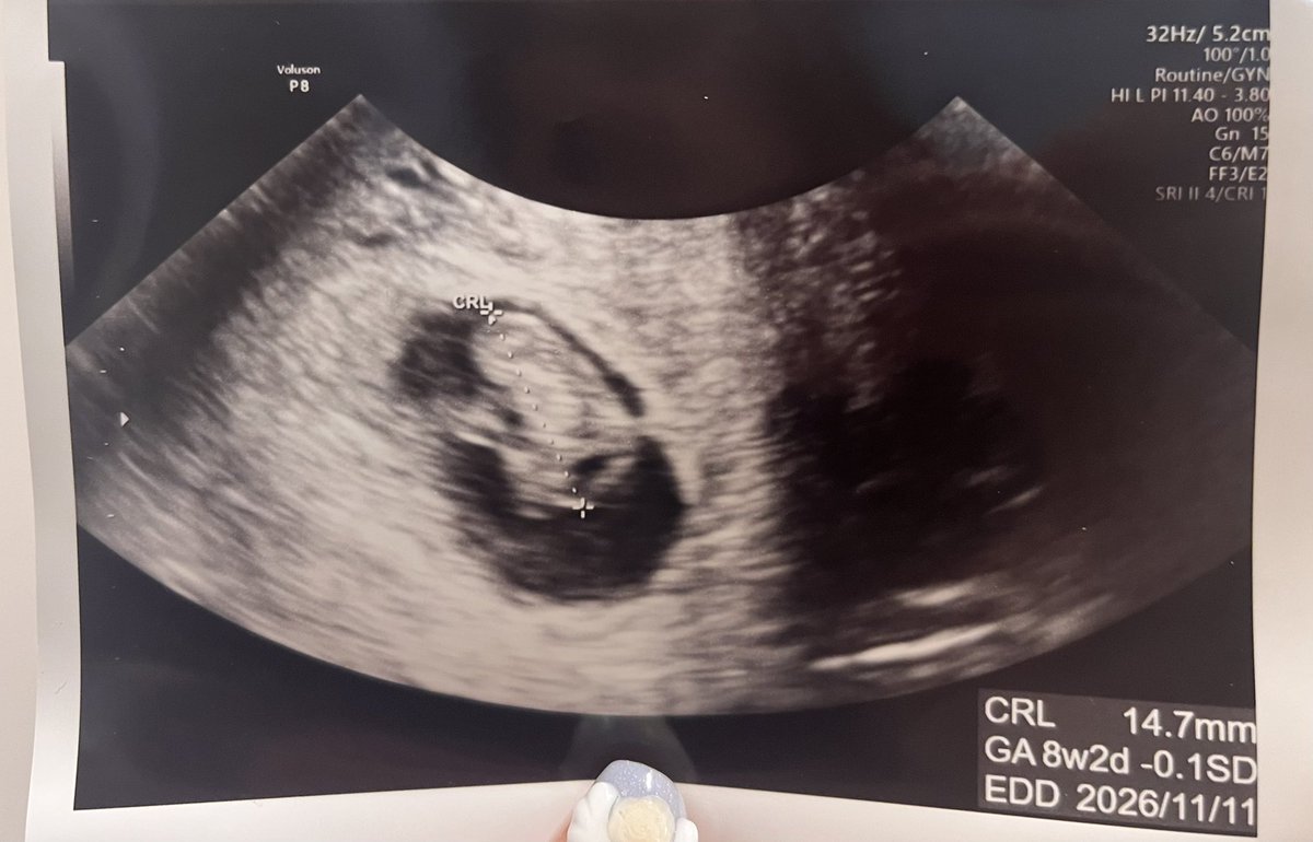 ちゅん🌸初マタ8w tweet media