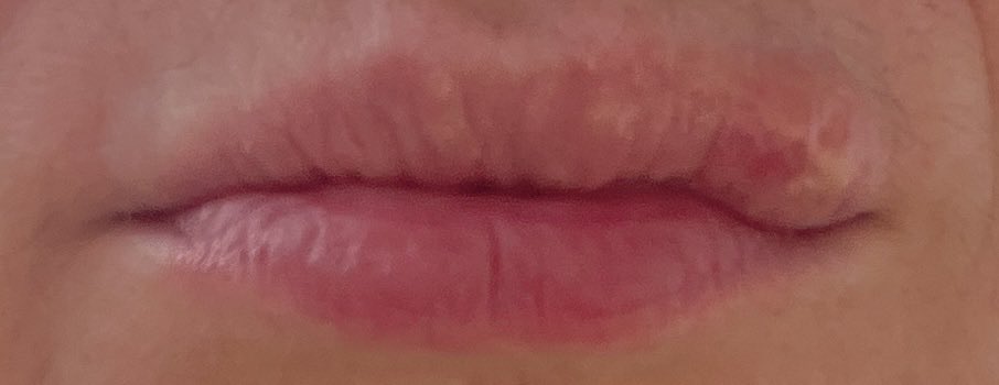 Ana Brunčič tweet media