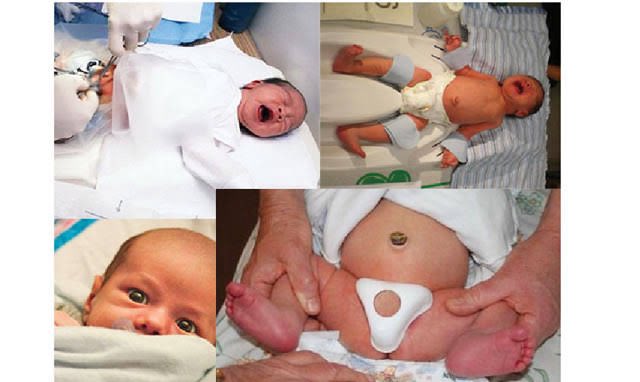 Joseph Lewis tweet media