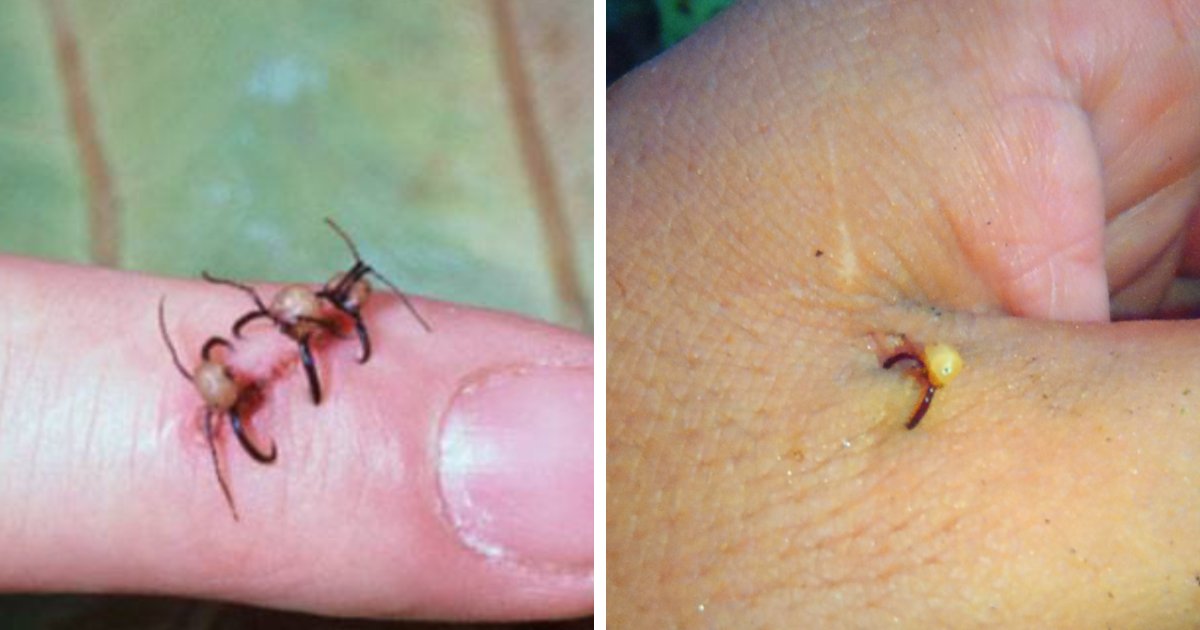 BigBangSciCom's tweet photo. 🐜 Les fourmis légionnaires du genre Dorylus sont connues pour lâcher difficilement prise. Elles sont parfois utilisées pour suturer des plaies : les fourmis pincent la plaie, puis leur corps est retiré

⚠️ Ces photos montrent des fourmis du genre Eciton 

#fourmis #entomologie https://t.co/cmafwdc1Eu