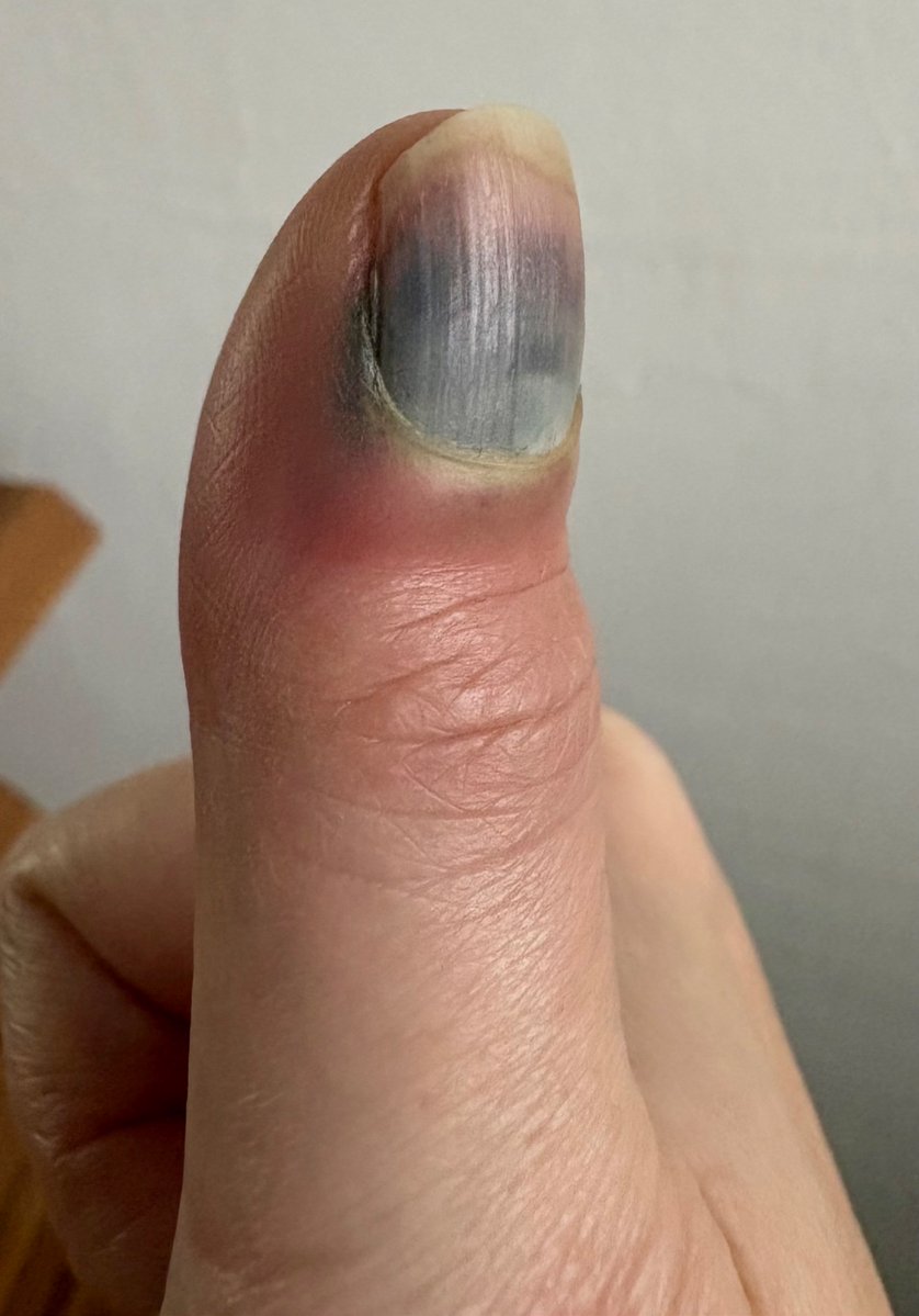 @lenkabeee tweet media