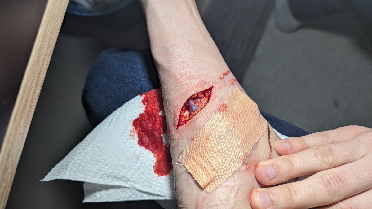 utilityknife - 🇫🇮 - shedtwt tweet media