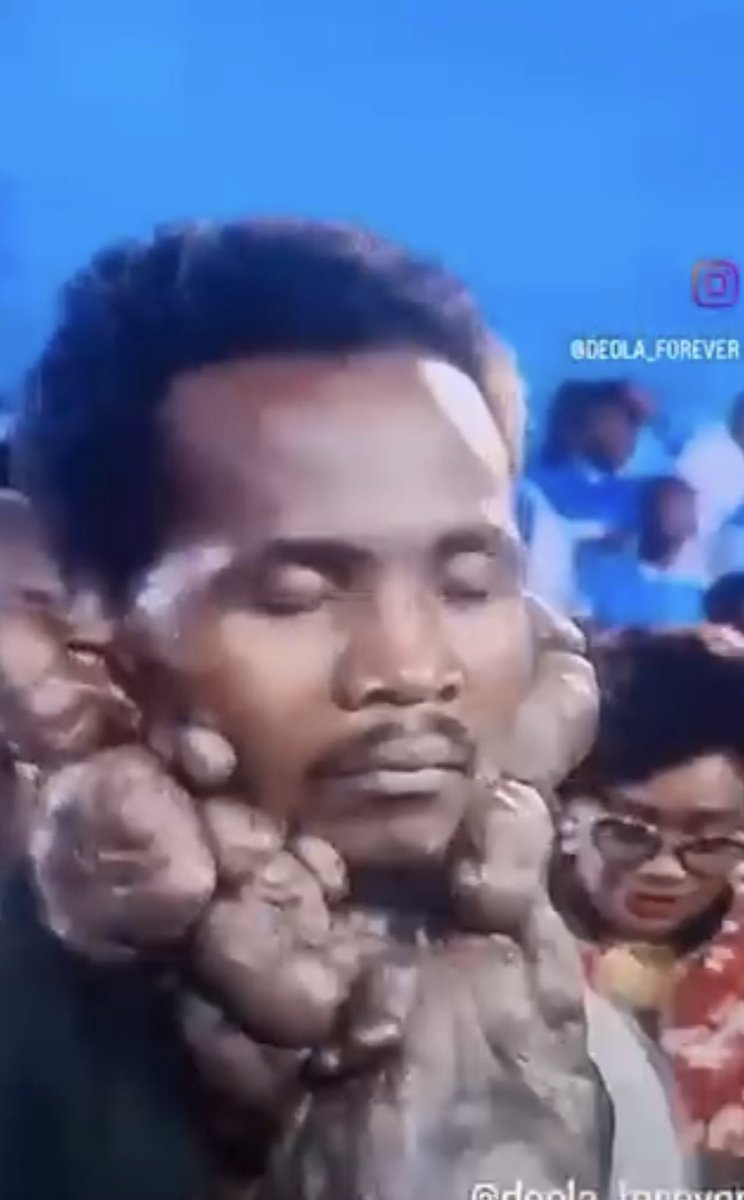 Just out of curiosity, does anyone know if he's healed yet?... has anyone heard from him or bothered to check? or have we just moved on?