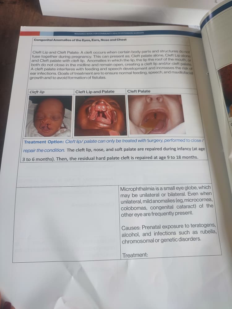 (SHAU) Spina Bifida & Hydrocephalus Assoc. Uganda tweet media