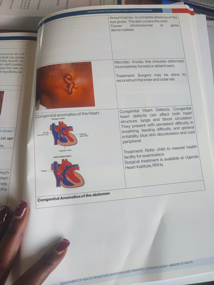 (SHAU) Spina Bifida & Hydrocephalus Assoc. Uganda tweet media