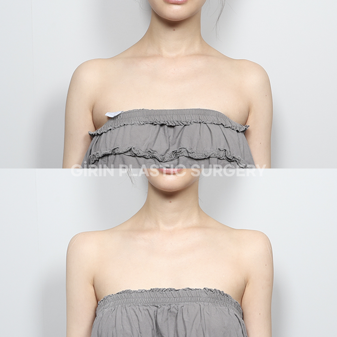 【公式】韓国整形ギリン美容外科 tweet media