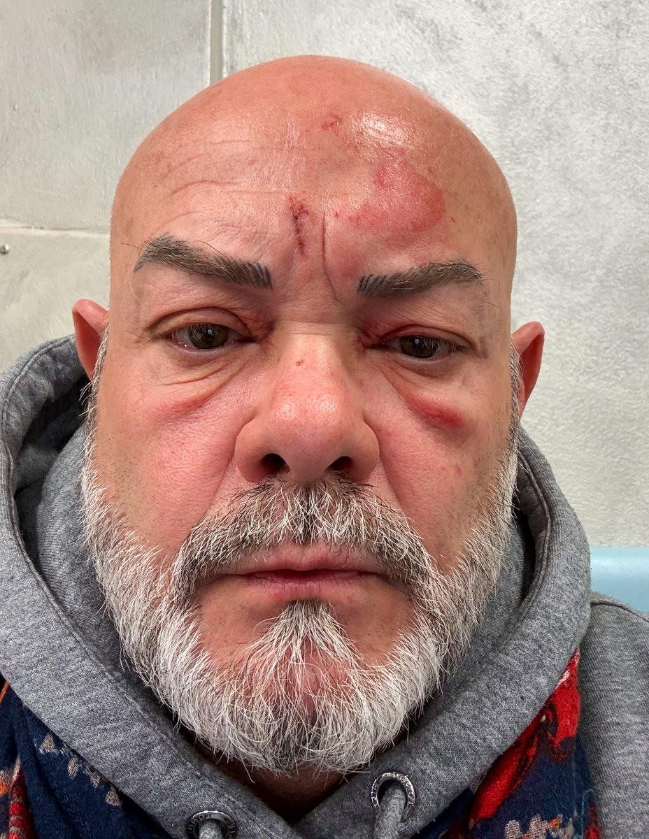 Rudi De Fanti tweet media